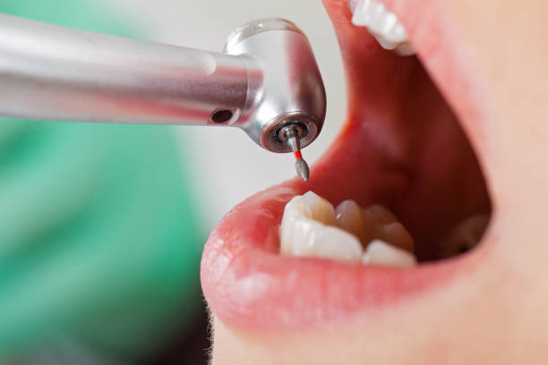 Best Emergency Treatment for Jaw Pain or Injury in Edmonds, WA